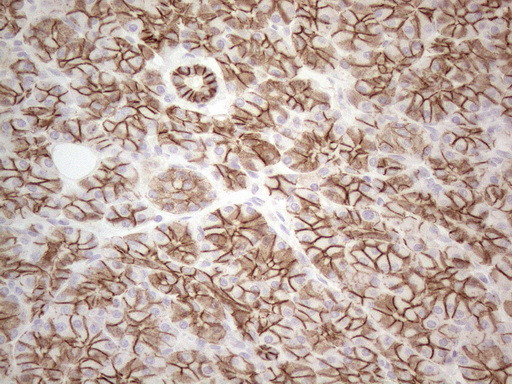 Pan-CDH Antibody in Immunohistochemistry (Paraffin) (IHC (P))