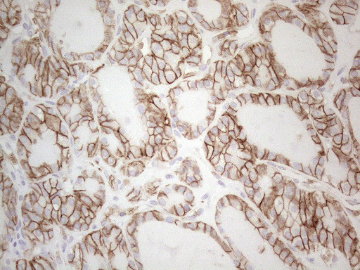 Pan-CDH Antibody in Immunohistochemistry (Paraffin) (IHC (P))