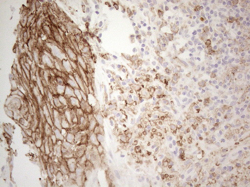 Pan-CDH Antibody in Immunohistochemistry (Paraffin) (IHC (P))