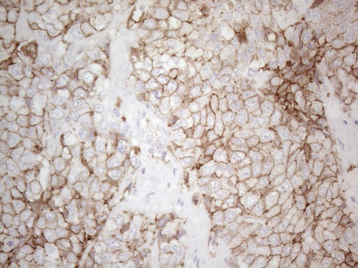 Pan-CDH Antibody in Immunohistochemistry (Paraffin) (IHC (P))