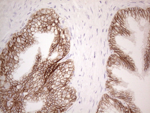 Pan-CDH Antibody in Immunohistochemistry (Paraffin) (IHC (P))