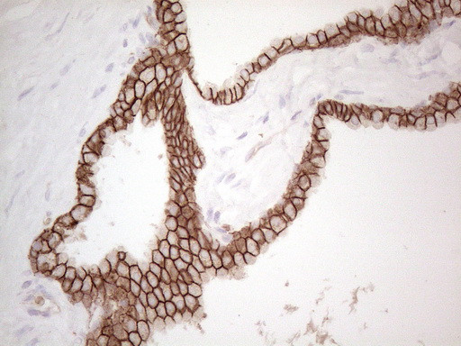 Pan-CDH Antibody in Immunohistochemistry (Paraffin) (IHC (P))