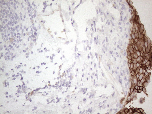 Pan-CDH Antibody in Immunohistochemistry (Paraffin) (IHC (P))