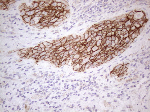 Pan-CDH Antibody in Immunohistochemistry (Paraffin) (IHC (P))