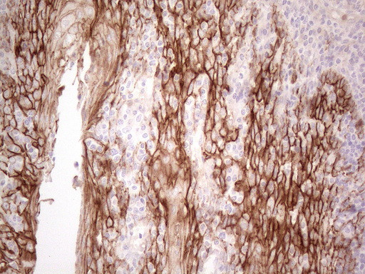 Pan-CDH Antibody in Immunohistochemistry (Paraffin) (IHC (P))