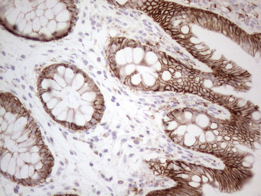 Pan-CDH Antibody in Immunohistochemistry (Paraffin) (IHC (P))