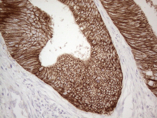 Pan-CDH Antibody in Immunohistochemistry (Paraffin) (IHC (P))