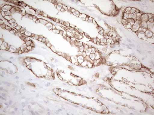 Pan-CDH Antibody in Immunohistochemistry (Paraffin) (IHC (P))