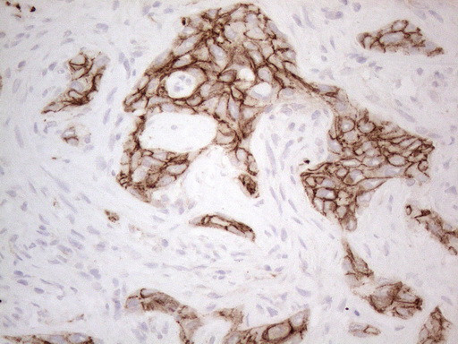 Pan-CDH Antibody in Immunohistochemistry (Paraffin) (IHC (P))