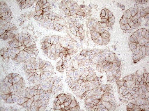 Pan-CDH Antibody in Immunohistochemistry (Paraffin) (IHC (P))