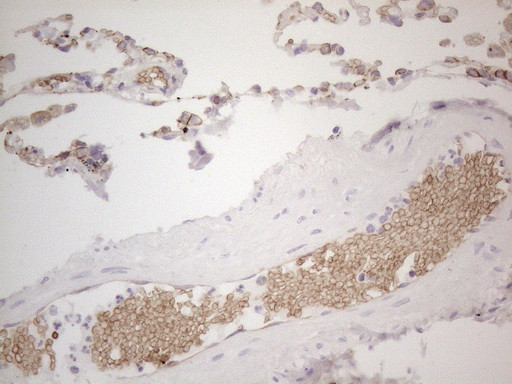 Pan-CDH Antibody in Immunohistochemistry (Paraffin) (IHC (P))