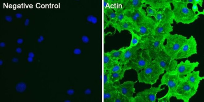 Actin Antibody in Immunocytochemistry (ICC/IF)