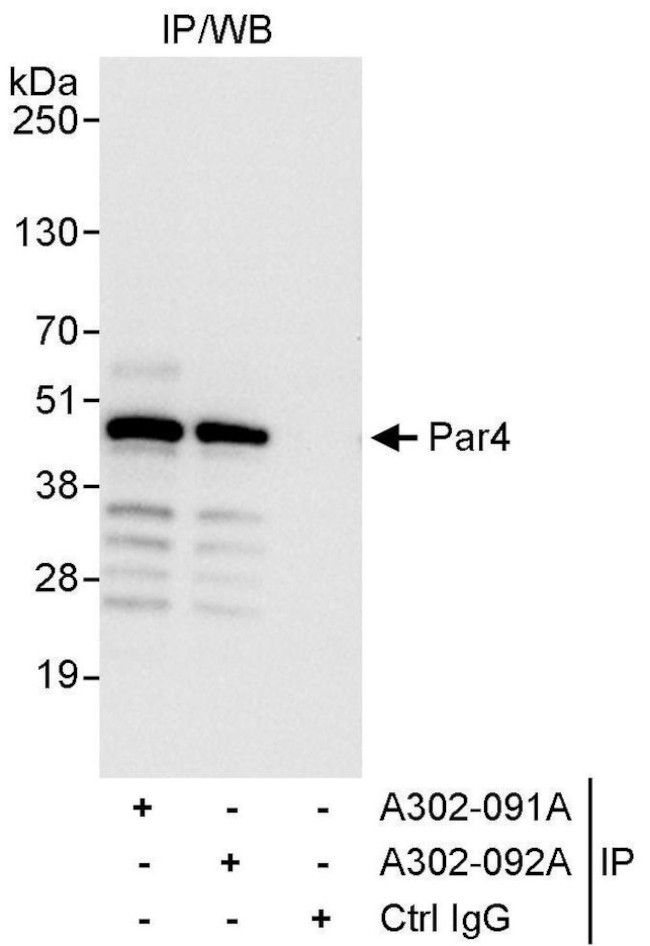 Par4 Antibody in Immunoprecipitation (IP)