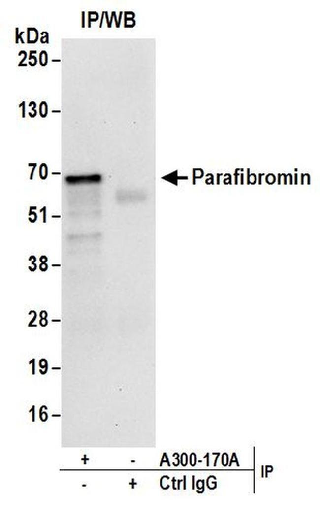 Parafibromin Antibody in Western Blot (WB)