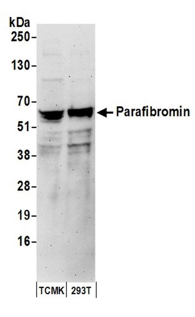 Parafibromin Antibody in Western Blot (WB)