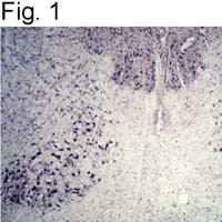 Parkin Antibody in Immunohistochemistry (IHC)