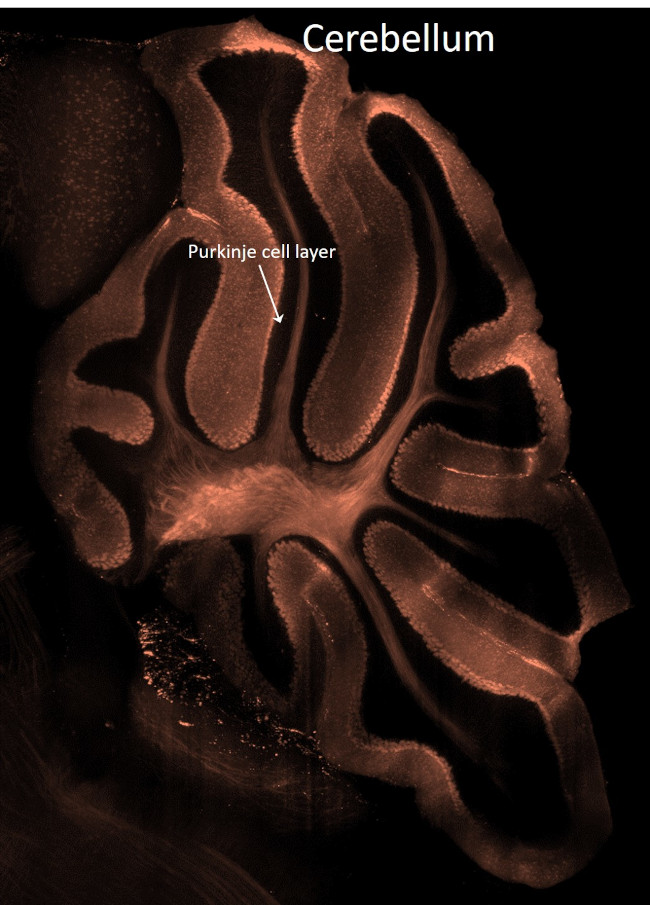 Parvalbumin Antibody in Immunohistochemistry (IHC)