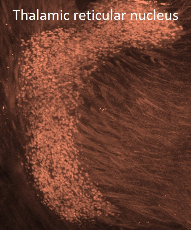 Parvalbumin Antibody in Immunohistochemistry (IHC)