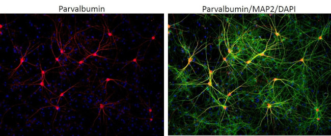 Parvalbumin Antibody in Immunocytochemistry (ICC/IF)