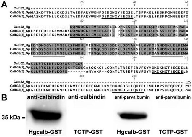 Parvalbumin Antibody in Western Blot (WB)