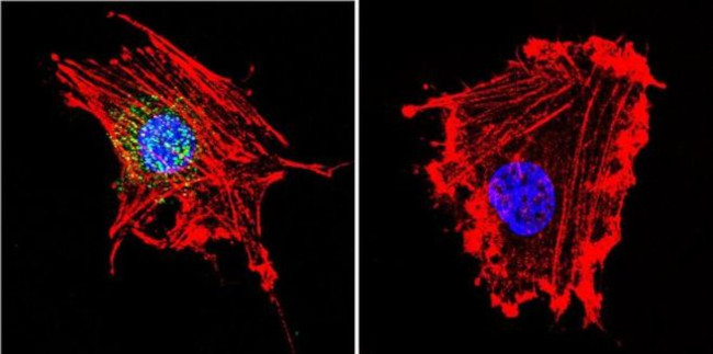 Parvalbumin Antibody in Immunocytochemistry (ICC/IF)