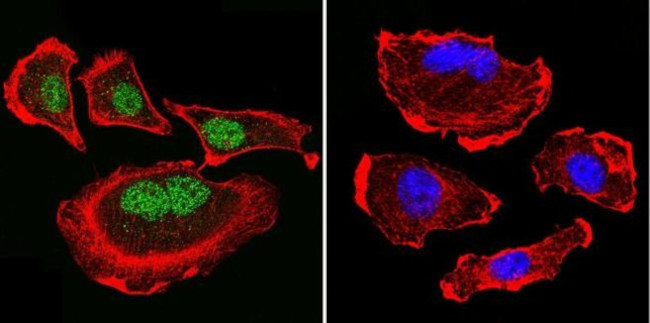 Parvalbumin Antibody in Immunocytochemistry (ICC/IF)