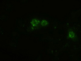 Patched1 Antibody in Immunocytochemistry (ICC/IF)