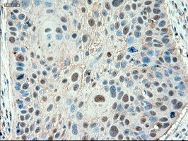 Patched1 Antibody in Immunohistochemistry (Paraffin) (IHC (P))