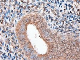 Patched1 Antibody in Immunohistochemistry (Paraffin) (IHC (P))