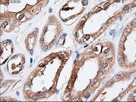 Patched1 Antibody in Immunohistochemistry (Paraffin) (IHC (P))