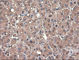 Patched1 Antibody in Immunohistochemistry (Paraffin) (IHC (P))