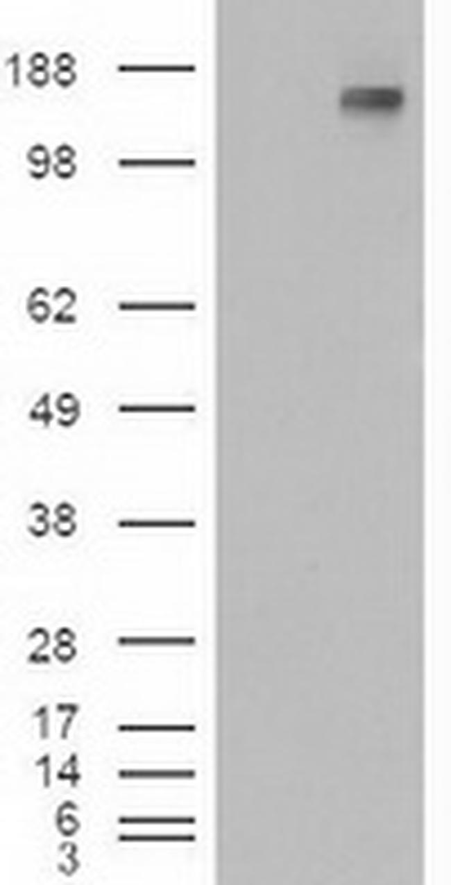 Patched1 Antibody in Western Blot (WB)