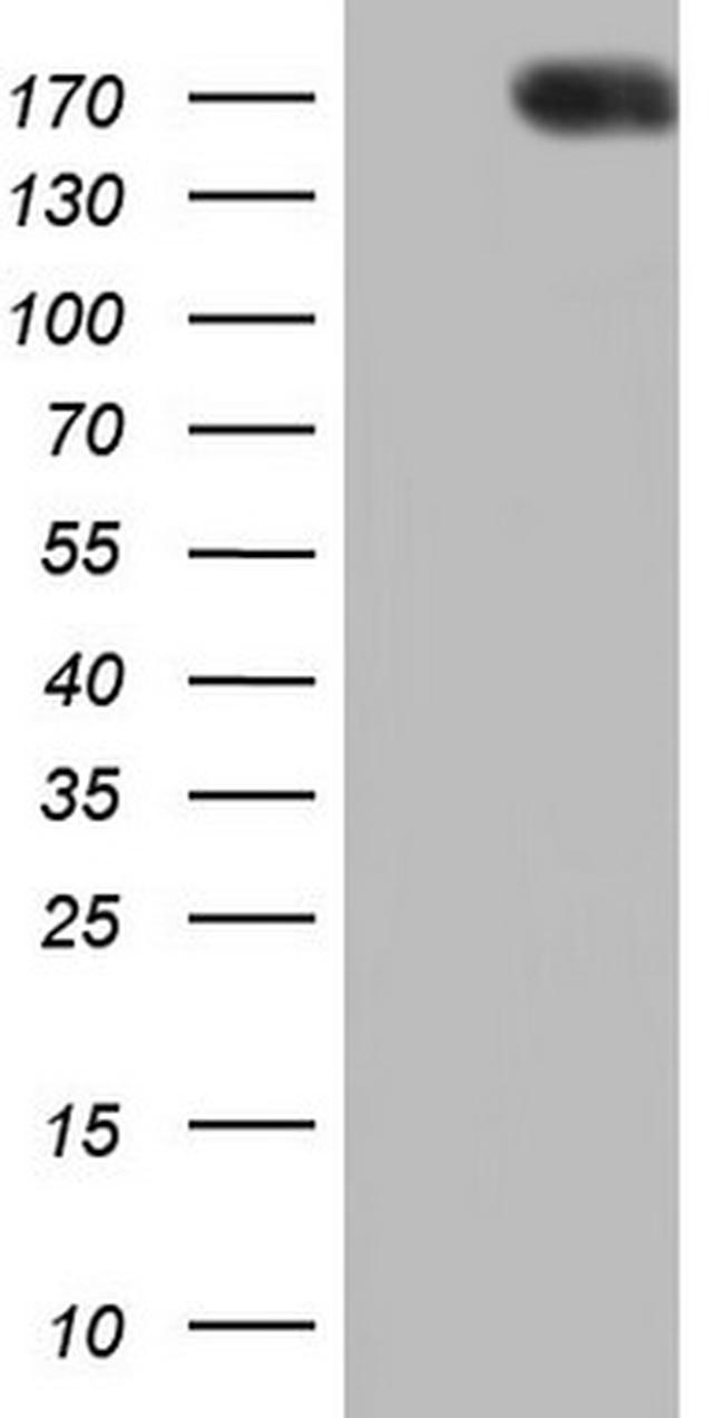 Patched1 Antibody in Western Blot (WB)