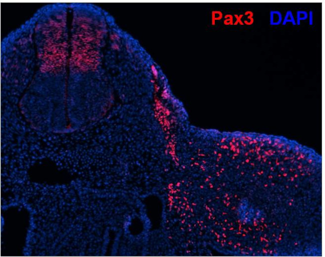 PAX3 Antibody in Immunohistochemistry (Frozen) (IHC (F))