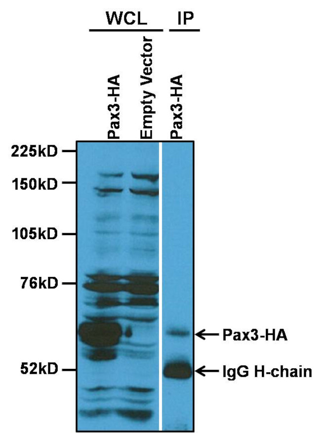 PAX3 Antibody in Immunoprecipitation (IP)