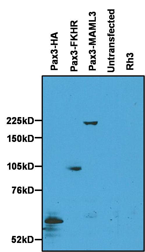 PAX3 Antibody in Western Blot (WB)