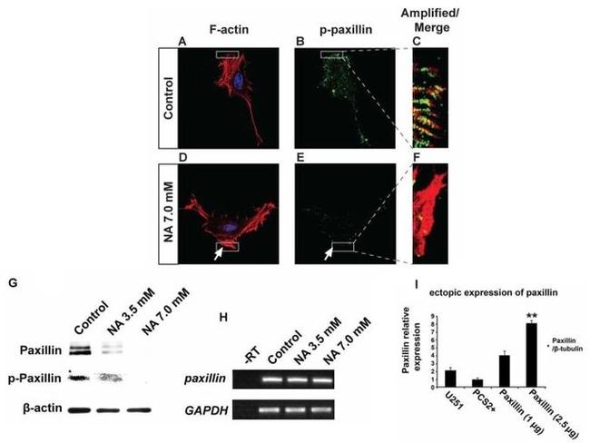 Paxillin Antibody in Western Blot (WB)