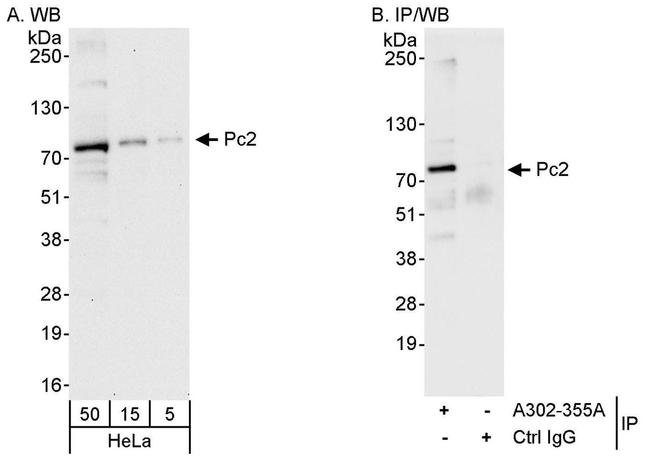 Pc2 Antibody in Western Blot (WB)