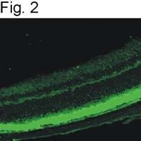 PDE6B Antibody in Immunohistochemistry (IHC)