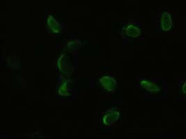 Pdx1 Antibody in Immunocytochemistry (ICC/IF)