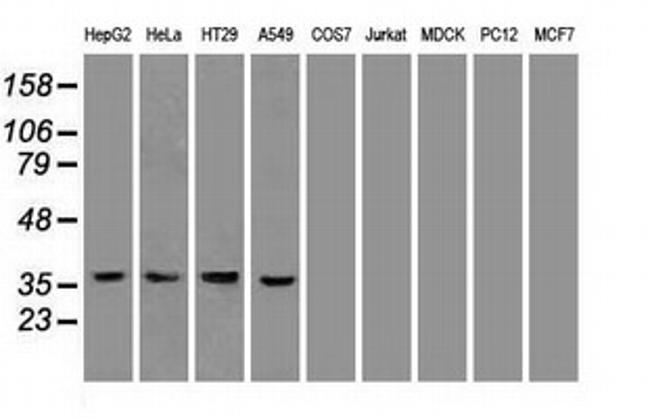 Pdx1 Antibody in Western Blot (WB)