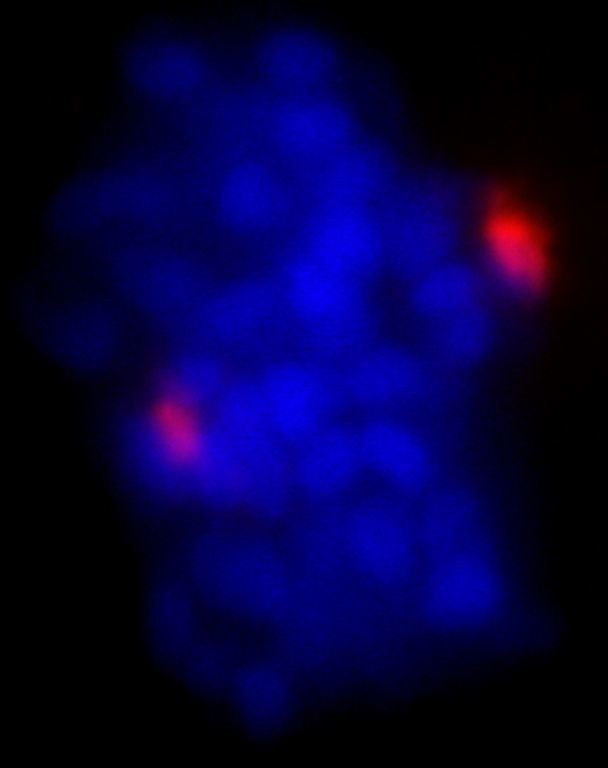 Pericentrin/Kendrin Antibody in Immunocytochemistry (ICC/IF)