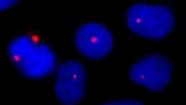 Pericentrin/Kendrin Antibody in Immunocytochemistry (ICC/IF)