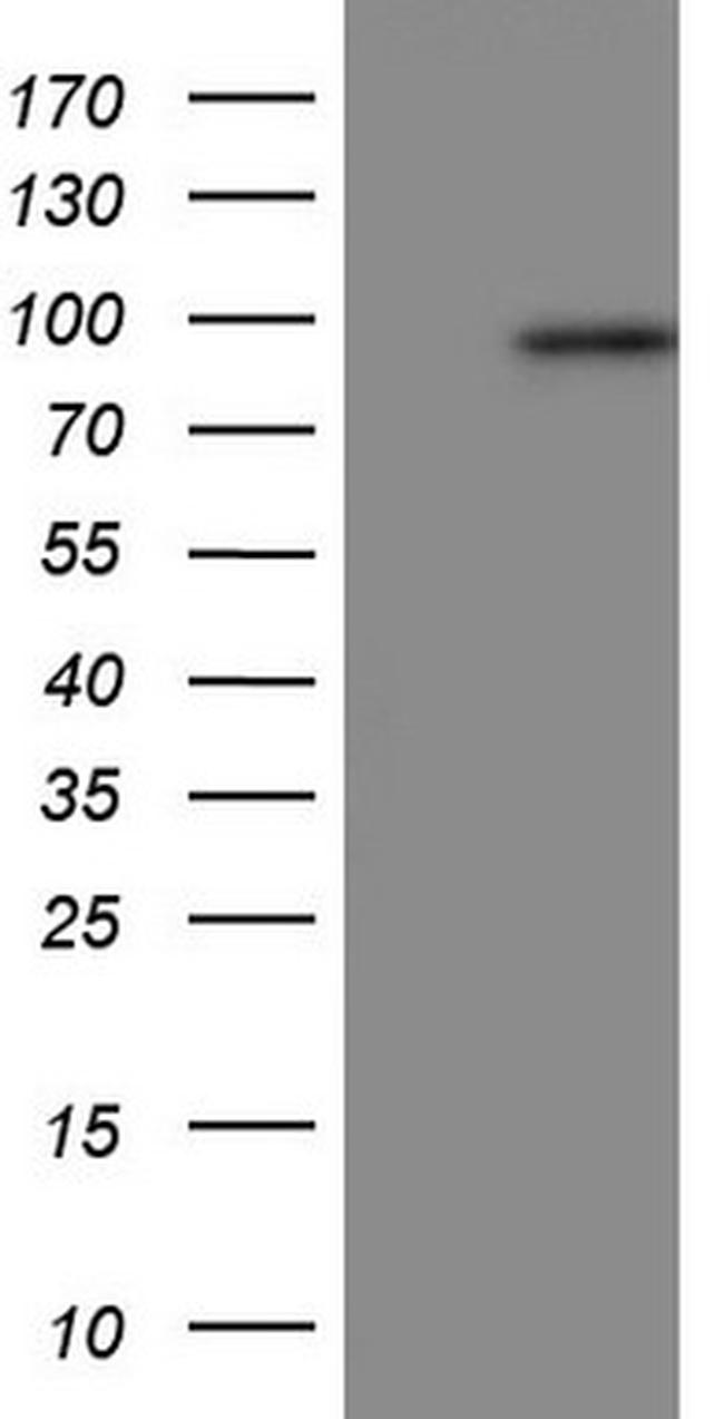 Periostin Antibody in Western Blot (WB)