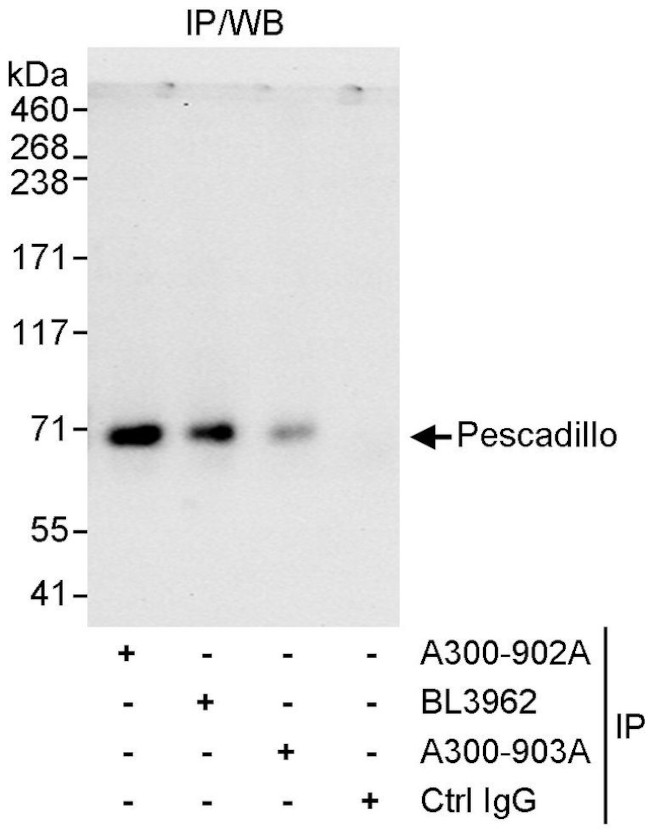 Pescadillo Antibody in Immunoprecipitation (IP)