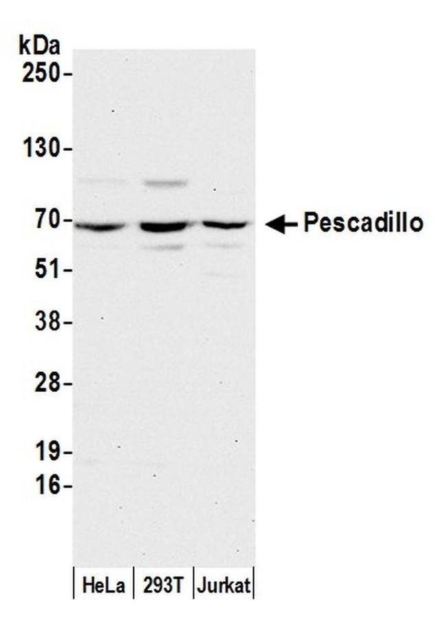 Pescadillo Antibody in Western Blot (WB)