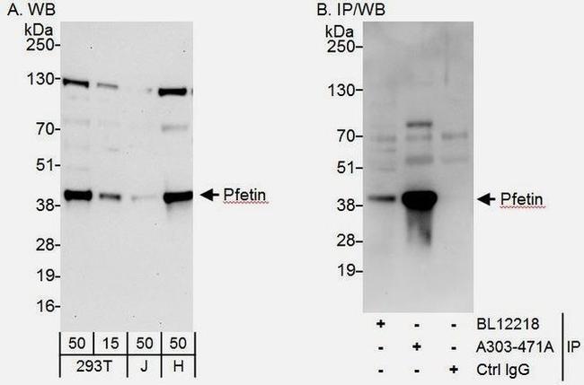 Pfetin Antibody in Western Blot (WB)