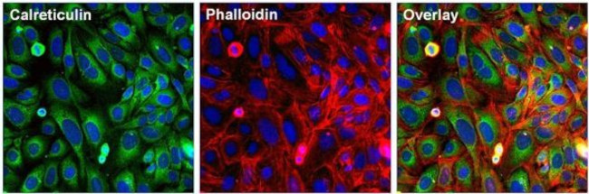 Phalloidin Control in Immunocytochemistry (ICC/IF)