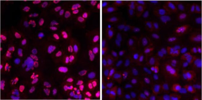 Phospho-ATM (Ser1981) Antibody in Immunocytochemistry (ICC/IF)