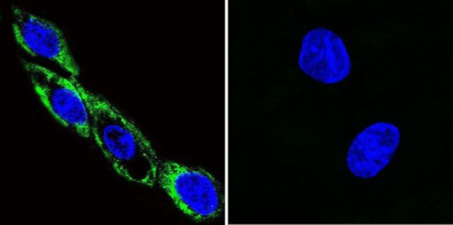 Phospho-CaMKII alpha (Thr286) Antibody in Immunocytochemistry (ICC/IF)